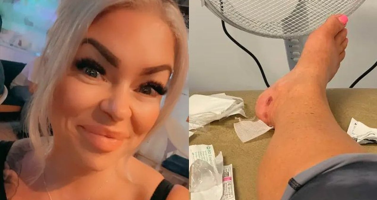 ingiliz kadinin bodrumdaki luks otelde yaptigi tatil ulkesine donunce kabusa dondu mrTKVedk.jpg