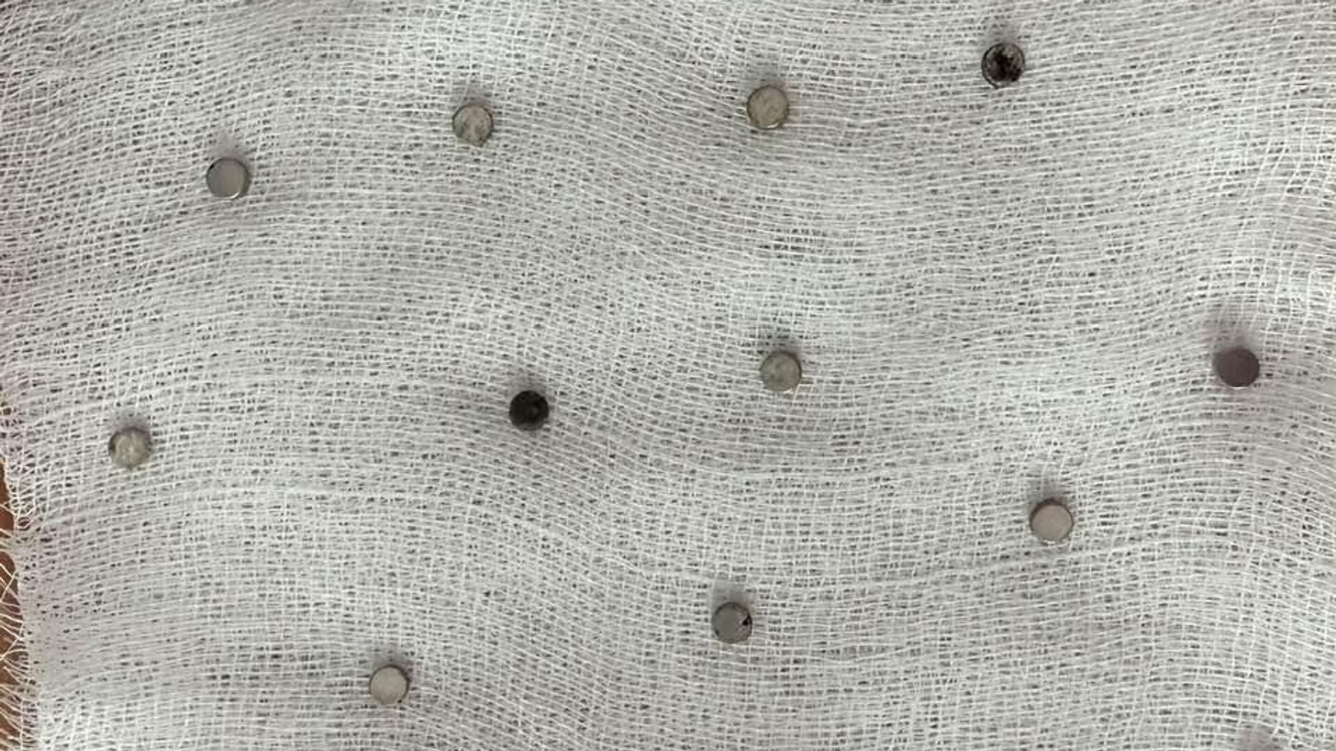 toplam 19 miknatis yemek borusundan cikarildi ywARACnx