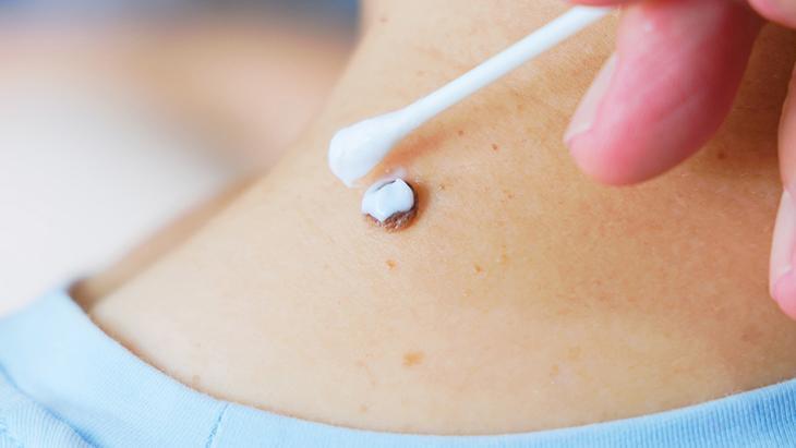 lazerle aldiran da var solusyon suren de her ben masum degil incelenmeli E8FjnTNf.jpg